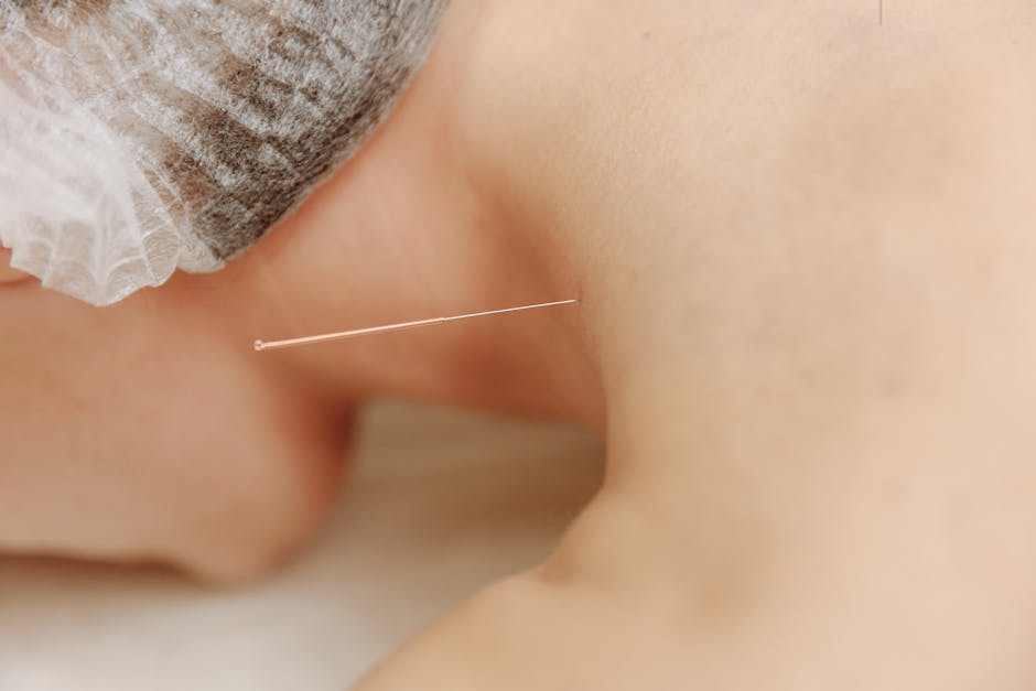 Detailed close-up image of an acupuncture needle inserted into skin, showcasing traditional Chinese medicine.